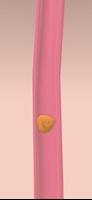 Intestine Adventure اسکرین شاٹ 1