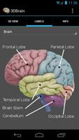 3D Brain imagem de tela 2