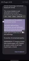 Zettel Notes: OCR Plugin Ekran Görüntüsü 4