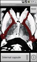 NeuroSlice ảnh chụp màn hình 1