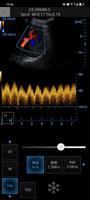 Ultrasound Touch ポスター