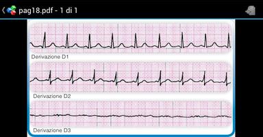 ECG fast APP capture d'écran 1