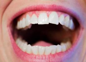 Mouth Ulcers Cure Ekran Görüntüsü 1