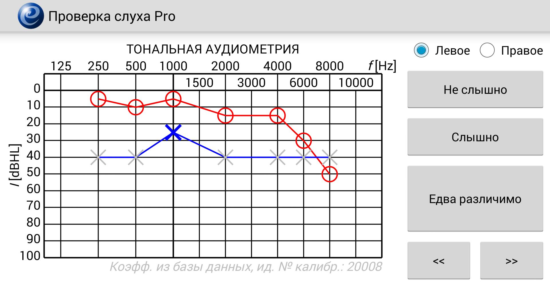 Расшифровка аудиограммы