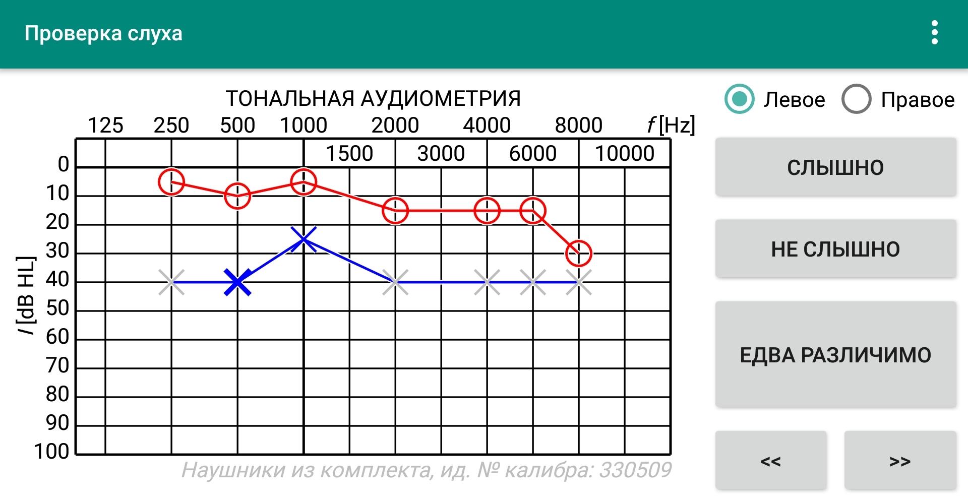 Аудиограмма в спб. Спидометр для проверки слуха.