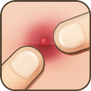 Pimple Popper APK