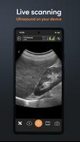 1 Schermata App Clarius Ultrasound