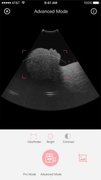 Fetus Camera screenshot 1