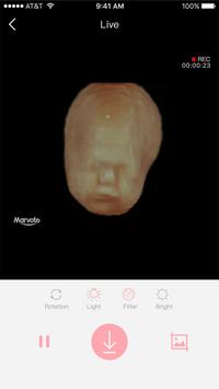 Fetus Camera screenshot 2