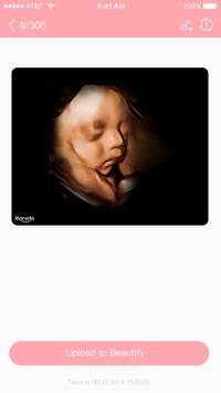 Fetus Camera screenshot 4
