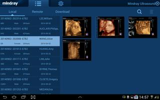 MedSight HD ภาพหน้าจอ 2