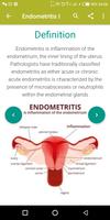 AZ Gynecology Ultrasound Guide Affiche