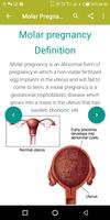 AZ Gynecology Ultrasound Guide capture d'écran 1