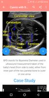 A-Z Obstetrics Ultrasound Guid screenshot 3