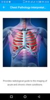 A-Z Chest XRay Pathology Guide Affiche