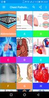 A-Z Chest XRay Pathology Guide capture d'écran 1