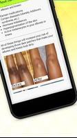 Get Rid Of Dark Knees And Elbows Fast & Naturally скриншот 2