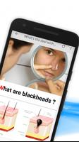 Get Rid Of Blackheads Naturally - 12 Home Remedies скриншот 2