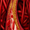 Home Remedies For Atherosclero APK