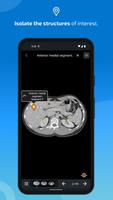 e-Anatomy syot layar 3