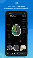 e-Anatomy syot layar 1