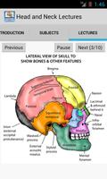 Head and Neck Lectures poster