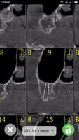 CBCT-Ruler Affiche