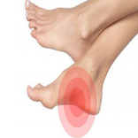 خار پاشنه را چگونه درمان کنیم؟