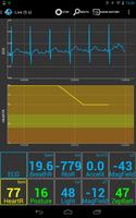 SenseView BT Zephyr Sensor Plakat