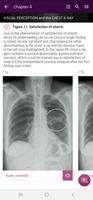 Chest X-Ray Interpretation Plakat