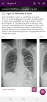 Chest X-Ray Interpretation Affiche