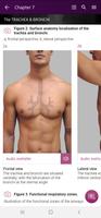 Chest X-Ray Interpretation Screenshot 2