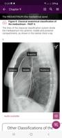 Chest X-Ray DEMO ảnh chụp màn hình 1