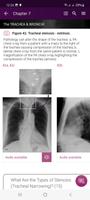 Chest X-Ray DEMO スクリーンショット 2