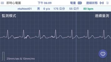 Q-ecg پوسٹر