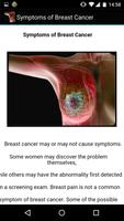 Symptoms of Breast Cancer تصوير الشاشة 3