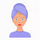 Как вылечить акне. Советы APK