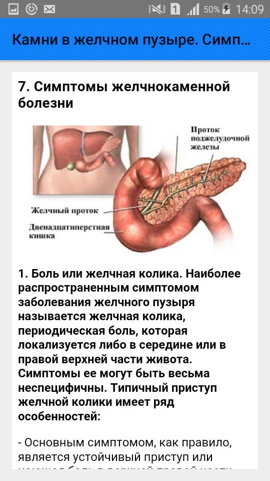 Камни в жёлчном пузыре симптомы. Желчно-пузырные симптомы. Инфильтрат желчного пузыря. Карман Гартмана в желчном пузыре это.