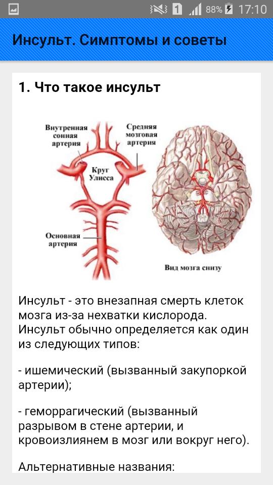 Почему бывает инсульт