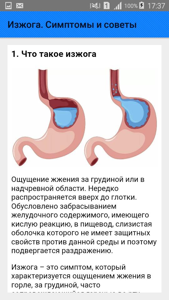 Почему изжога в горле. Изжога причины. Сильная изжога симптомы.