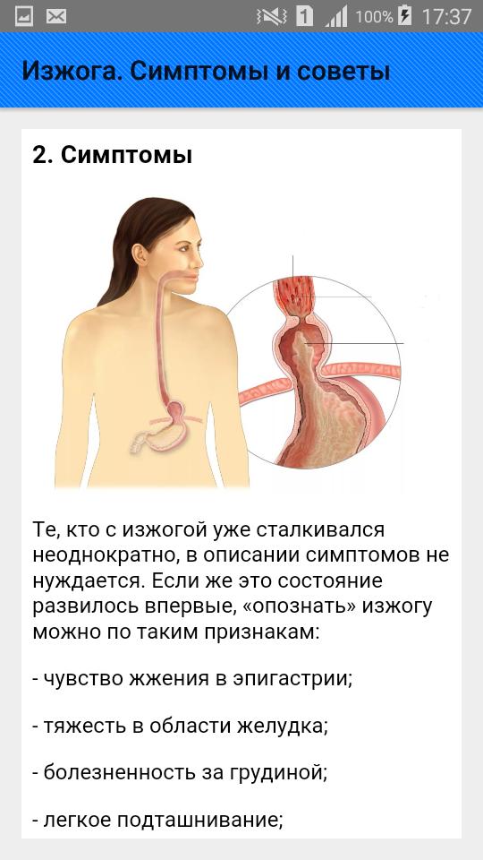 Изжога от воды почему. Симптомы изжоги симптомы.