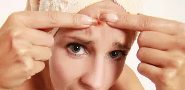Как убрать прыщи на лбу. Совет