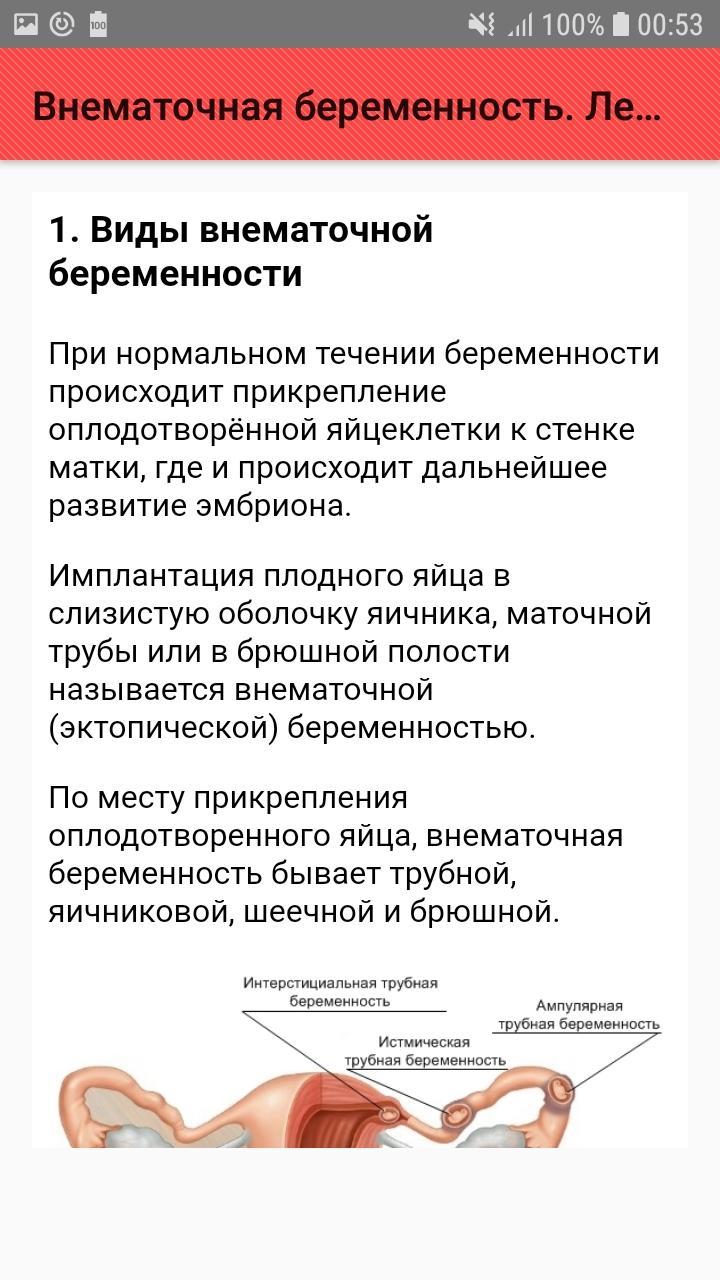 Можно сохранить внематочную беременность. Внематочная беременностт симпиом. Внематочная беременность симптомы. Причины внематочной беременности. Внематочнаябкременность.