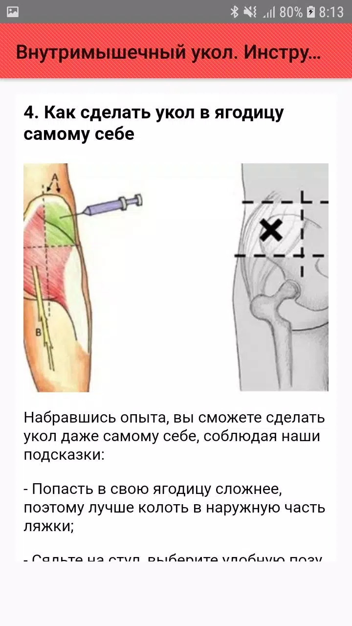 Сколько нужно колоть уколы