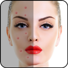 Acne Free : Pimple Remover أيقونة