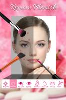 Acne Free : Pimple Remover पोस्टर