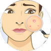 Acne Rescuers APK