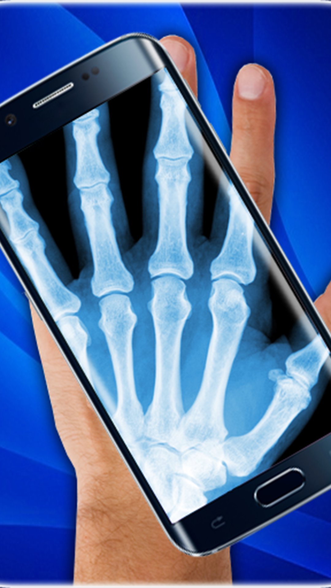 Filter Xray photos APK for Android Download