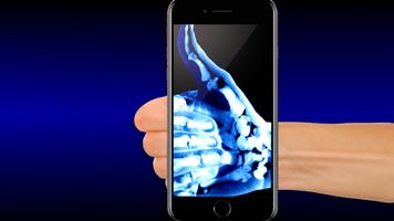 Roentgen xray photo editor ảnh chụp màn hình 2