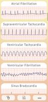 ECG Guide 海報